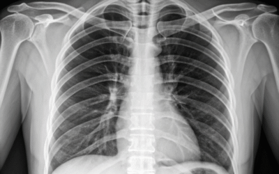 How Teleradiology Quality Assurance Actually Works: The Hidden Systems Hospitals Should Be Asking About