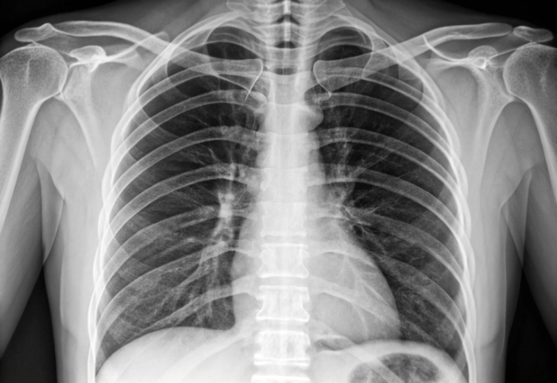 Teleradiology Service